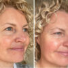 Restore Serum Obnovující sérum PŘED A PO (2)