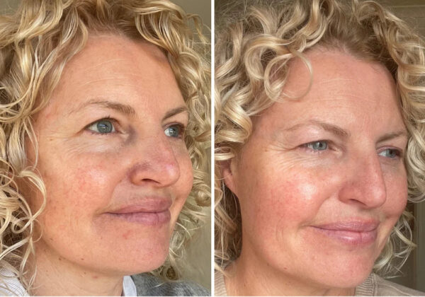 Restore Serum Obnovující sérum PŘED A PO (2)