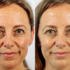 Restore Serum Obnovující sérum PŘED A PO (3)