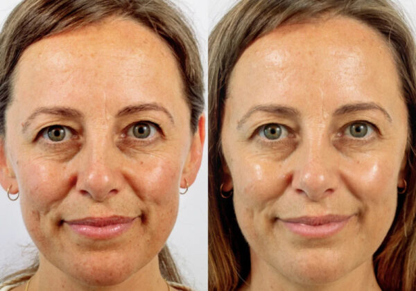 Restore Serum Obnovující sérum PŘED A PO (3)