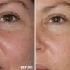 Retreatment Botancis Ultra Rich Moisturised Extra vyživující pleťový krém PŘED A PRO