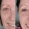 Retreatment Botancis Ultra Rich Moisturised Extra vyživující pleťový krém PŘED A PRO 2