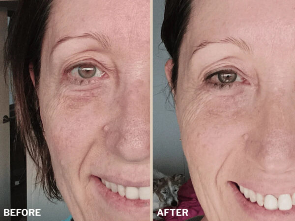 Retreatment Botancis Ultra Rich Moisturised Extra vyživující pleťový krém PŘED A PRO 2