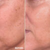 Retreatment Botancis Ultra Rich Moisturised Extra vyživující pleťový krém PŘED A PRO 3