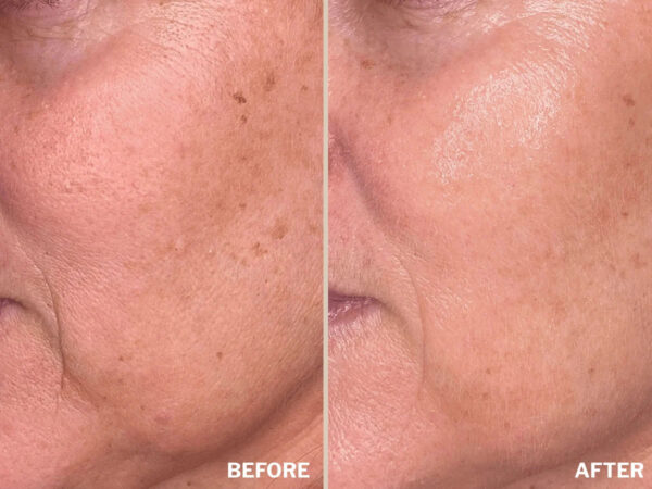 Retreatment Botancis Ultra Rich Moisturised Extra vyživující pleťový krém PŘED A PRO 3