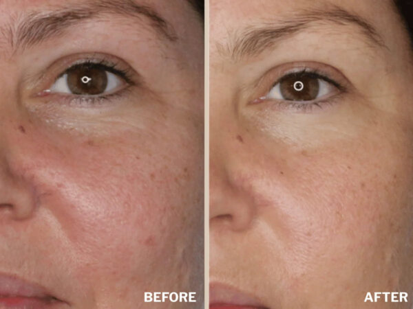Retreatment Botancis Ultra Rich Moisturised Extra vyživující pleťový krém PŘED A PRO