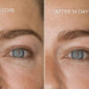 Retreatment Botanics Firming Eye Contour Cream Intenzivní výživný oční krém Před a Po (2)