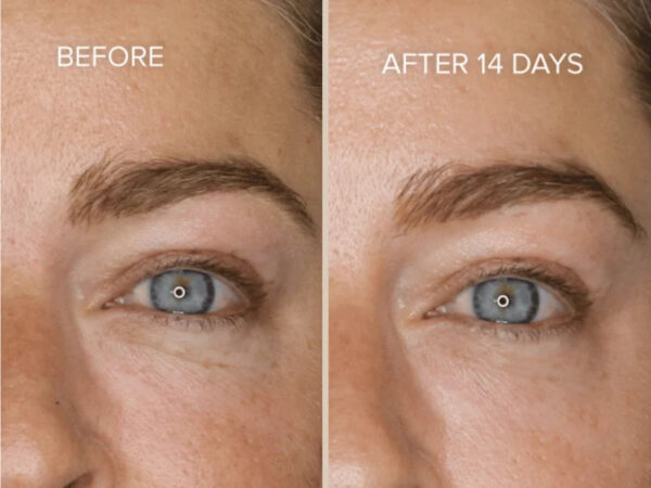 Retreatment Botanics Firming Eye Contour Cream Intenzivní výživný oční krém Před a Po (2)