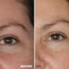 Retreatment Botanics Firming Eye Contour Cream Intenzivní výživný oční krém Před a Po (3)