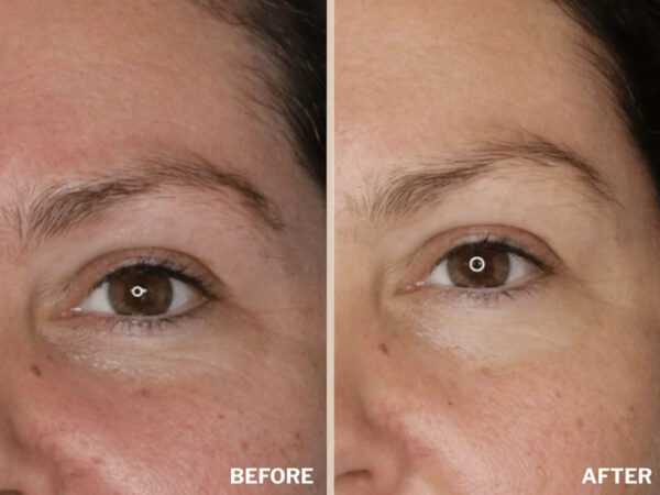 Retreatment Botanics Firming Eye Contour Cream Intenzivní výživný oční krém Před a Po (3)