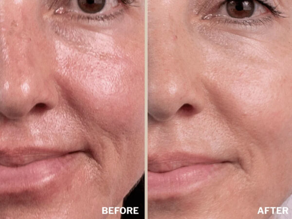 Retreatment Botanics Kakadu Brightening Serum Kakadu rozjasňující sérum PŘED A PO (1)