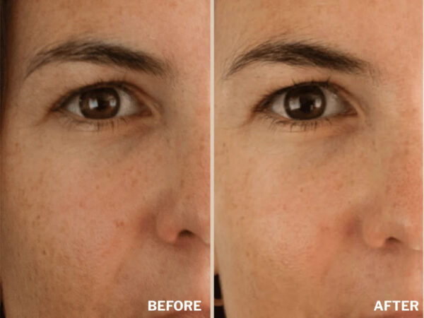 Retreatment Botanics Kakadu Brightening Serum Kakadu rozjasňující sérum PŘED A PO (2)