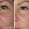 Retreatment Botanics Kakadu Brightening Serum Kakadu rozjasňující sérum PŘED A PO (3)