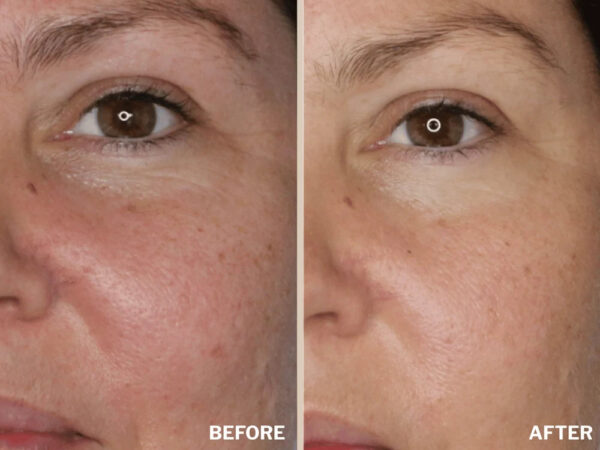 Retreatment Botanics Kakadu Brightening Serum Kakadu rozjasňující sérum PŘED A PO (3)
