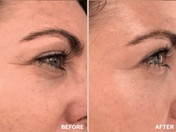 Retreatment Botanics Collagen Calm Activated Mist Kolagenový aktivátor na pleť Před a Po (1)