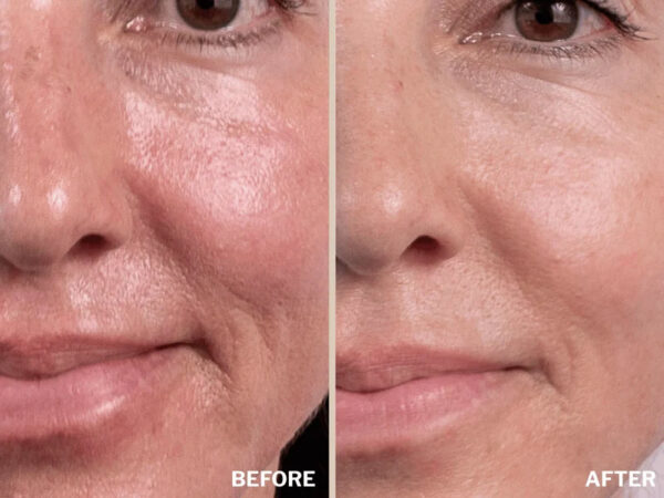 Retreatment Botanics Collagen Calm Activated Mist Kolagenový aktivátor na pleť Před a Po (2)