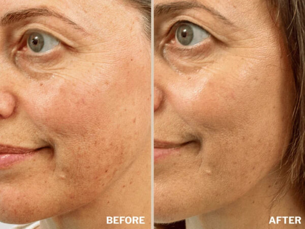 Retreatment Botanics Collagen Calm Activated Mist Kolagenový aktivátor na pleť Před a Po (3)