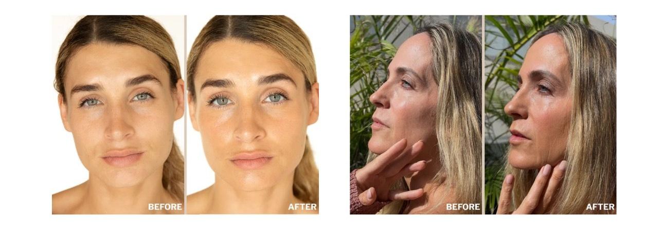 Collagen Gold Lifting Sheet Mask – 4 pack | Anti age kolagenová maska s koloidním zlatem 5_1