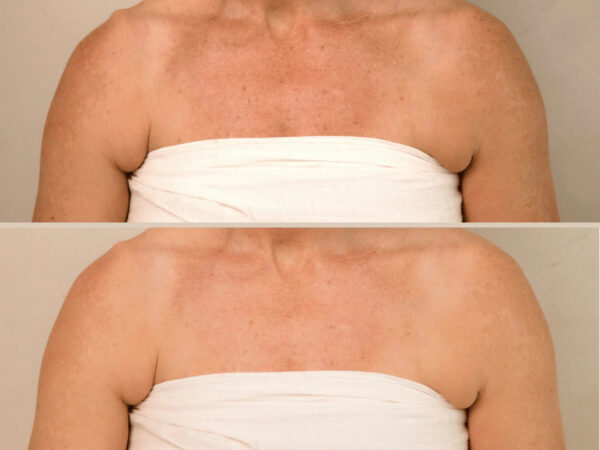 Retreatment Botanics The Body Renewal Set Obnovující tělový set 8