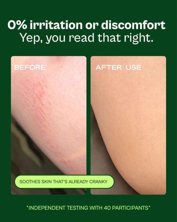 SKOOP Skin Shield Přírodní balzám proti odírání pokožky 8